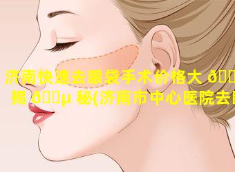 济南快速去眼袋手术价格大 🐛 揭 🌵 秘(济南市中心医院去眼袋手术多少钱)